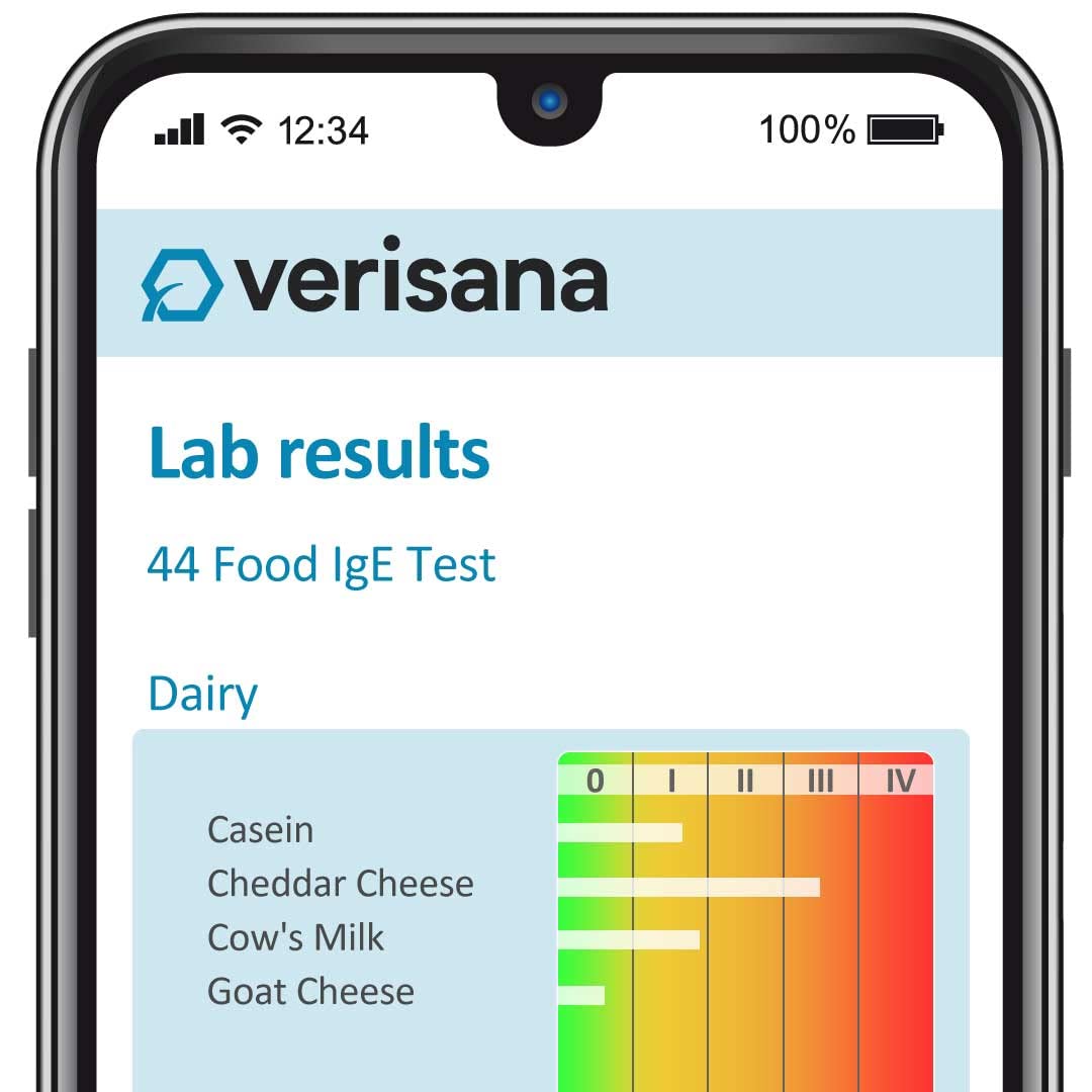 Food Allergy Test 44 Foods S34699